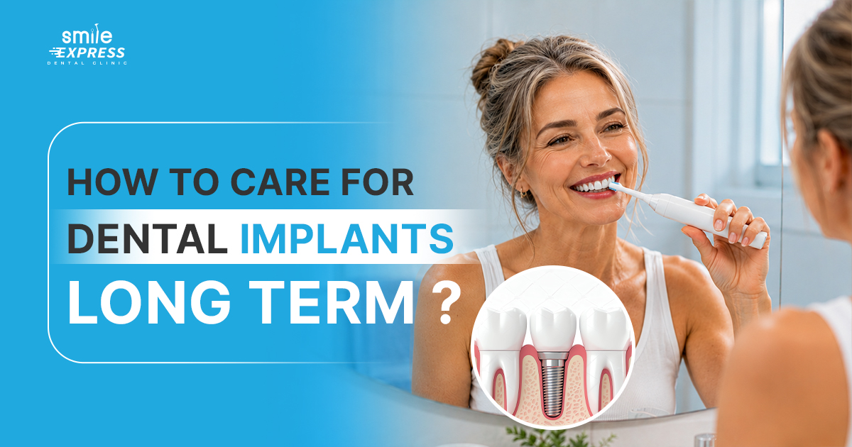 How to Care for dental implants long term